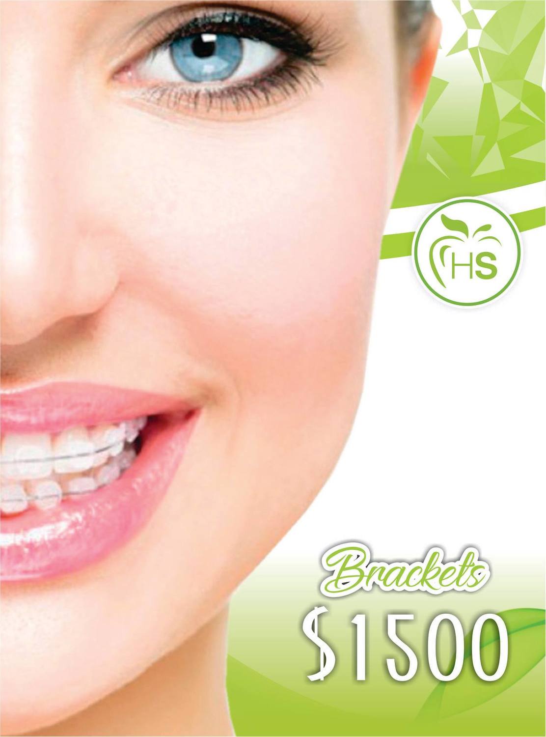 Brackets 