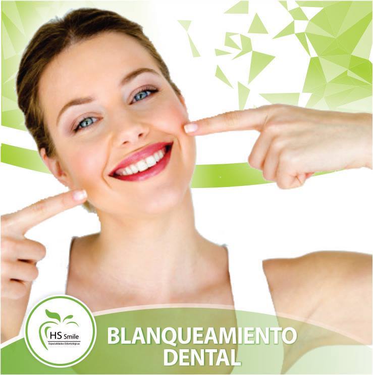 Blanqueamiento Dental 